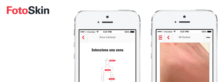 FotoSkin, app gratuita que ayuda al diagnóstico precoz del cáncer de piel