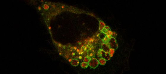 Cada año aumentan un 10% los casos de melanoma en España